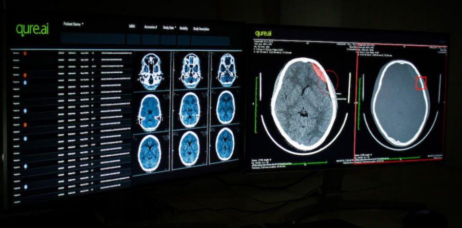 Healthtech Startup Qure.ai Is Using AI To Speed Up Radiology Diagnosis