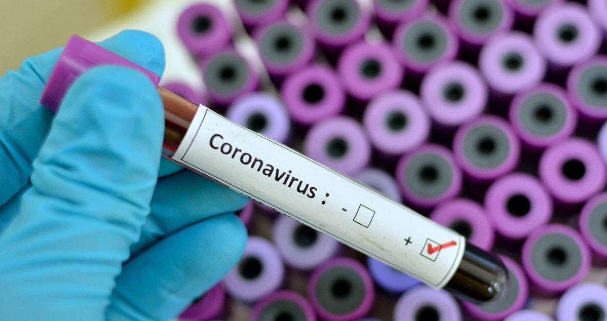 Scientists don't know if viral load is linked to severity of Coronavirus symptoms